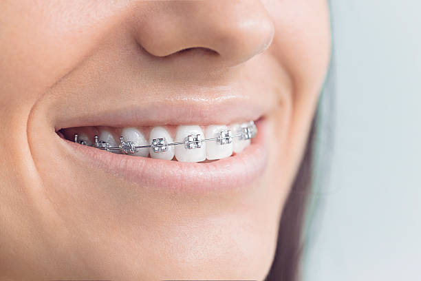 Laser Dentistry in Lennox, SD